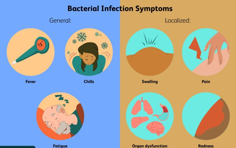 What are the 7 causes of infection?